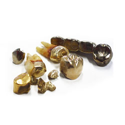 Zahngold mit Zähnen